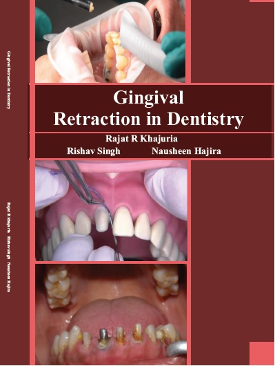 Gingival Retraction in Dentistry